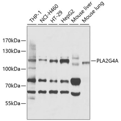 PLA2G4A Rabbit pAb