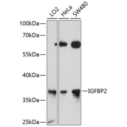 IGFBP2 Rabbit pAb
