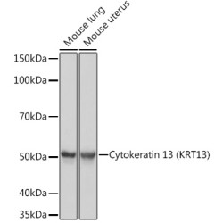 Cytokeratin 13 (KRT13) Rabbit mAb