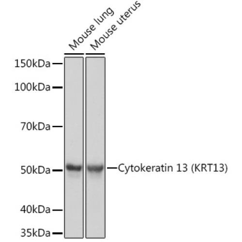 Cytokeratin 13 (KRT13) Rabbit mAb