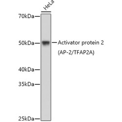 Activator protein 2 (AP-2/TFAP2A) Rabbit pAb