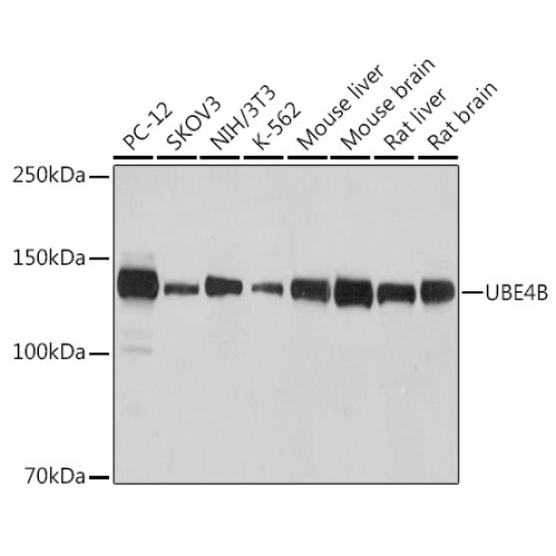 UBE4B Rabbit mAb