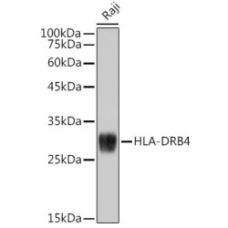 HLA-DRB4 Rabbit mAb