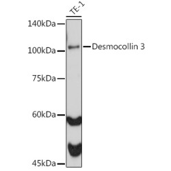 Desmocollin 3 Rabbit mAb