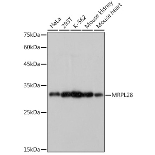 MRPL28 Rabbit mAb