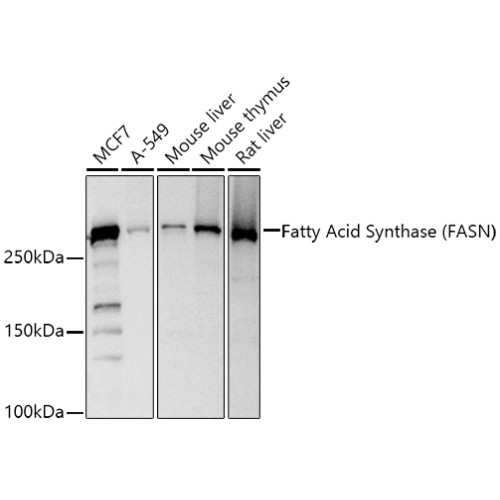 Fatty Acid Synthase (FASN) Rabbit pAb