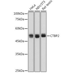 CTBP2 Rabbit mAb