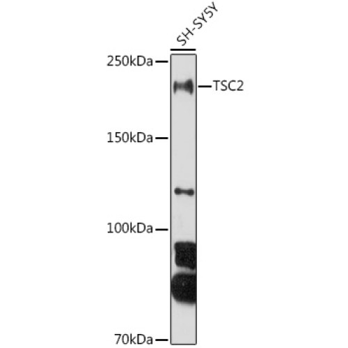 TSC2 Rabbit pAb