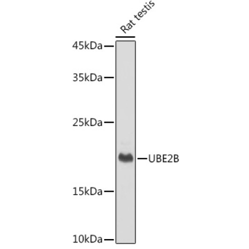 UBE2B Rabbit mAb