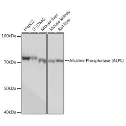 Alkaline Phosphatase (ALPL) Rabbit mAb