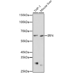 IRF4 Rabbit pAb