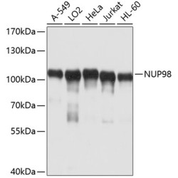 NUP98 Rabbit pAb