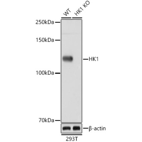 [KO Validated] HK1 Rabbit mAb