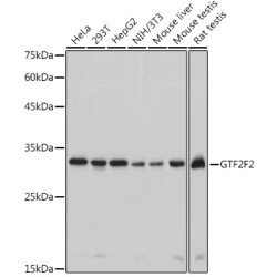 GTF2F2 Rabbit mAb