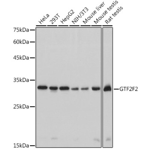 GTF2F2 Rabbit mAb