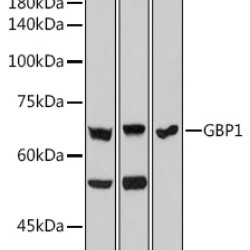 GBP1 Rabbit mAb