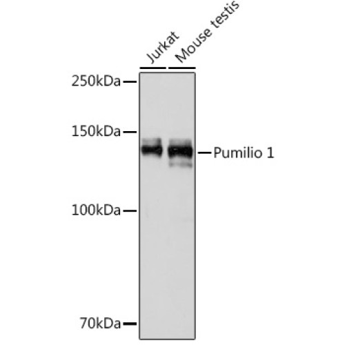 Pumilio 1 Rabbit mAb