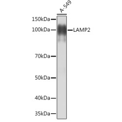 [KO Validated] LAMP2 Rabbit mAb
