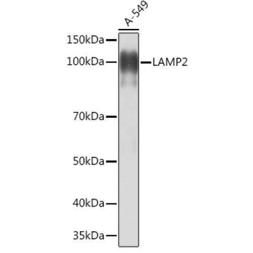 [KO Validated] LAMP2 Rabbit mAb