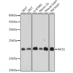NCS1 Rabbit mAb