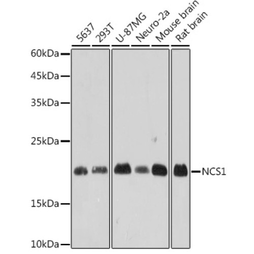 NCS1 Rabbit mAb