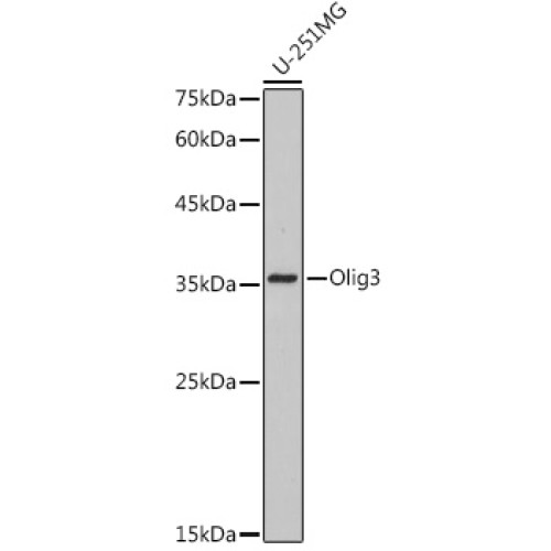 Olig3 Rabbit mAb