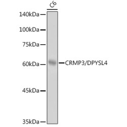 CRMP3/DPYSL4 Rabbit mAb