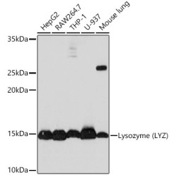Lysozyme (LYZ) Rabbit mAb