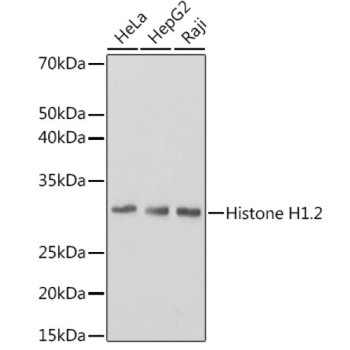 Histone H1.2 Rabbit mAb
