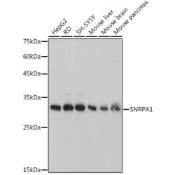 SNRPA1 Rabbit mAb