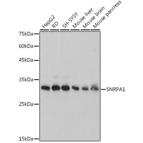 SNRPA1 Rabbit mAb