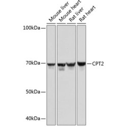 CPT2 Rabbit mAb