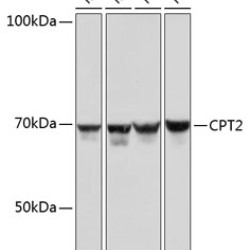 CPT2 Rabbit mAb