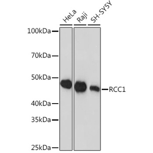 RCC1 Rabbit mAb