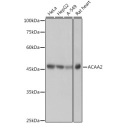 ACAA2 Rabbit mAb