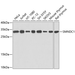 SMNDC1 Rabbit pAb
