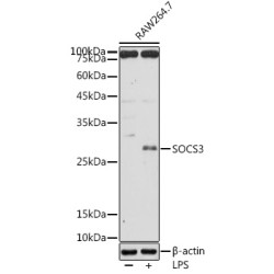 SOCS3 Rabbit pAb