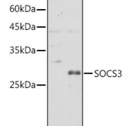 SOCS3 Rabbit pAb