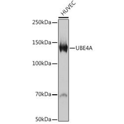 UBE4A Rabbit mAb