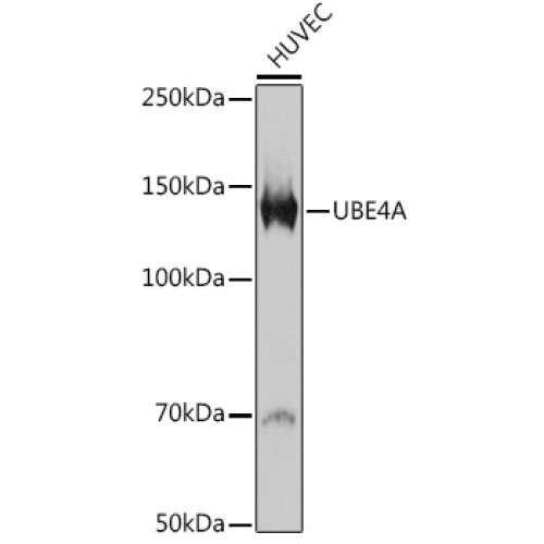 UBE4A Rabbit mAb