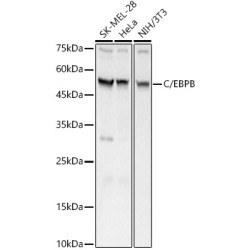 C/EBPB Rabbit pAb