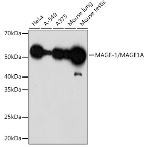 MAGE-1/MAGE1A Rabbit mAb