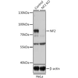 [KD Validated] NF2 Rabbit pAb