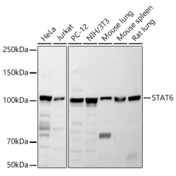 STAT6 Rabbit pAb