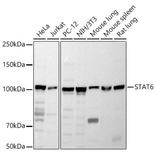 STAT6 Rabbit pAb