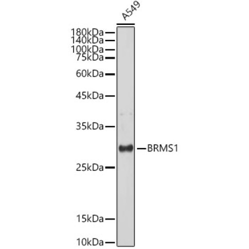 BRMS1 Rabbit mAb