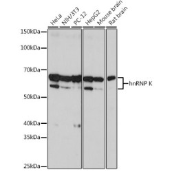 hnRNP K Rabbit mAb