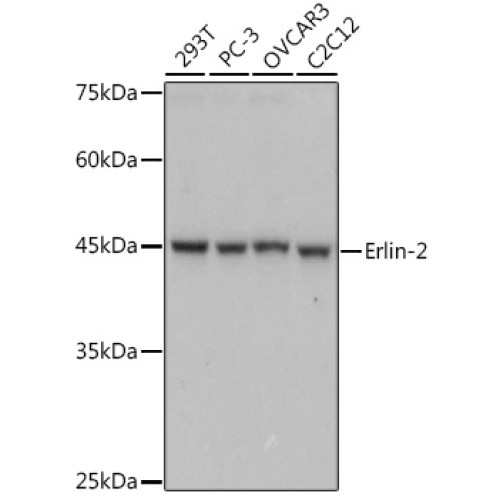 Erlin-2 Rabbit mAb