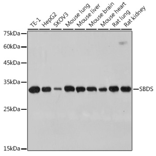 SBDS Rabbit mAb