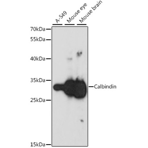 Calbindin Rabbit pAb